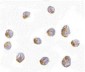 LIS1 Antibody